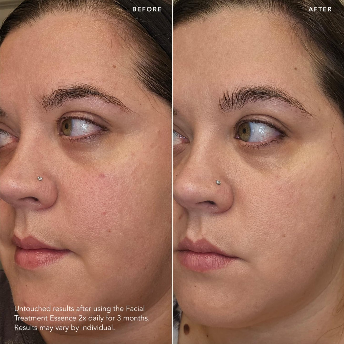 SK‑II Facial Treatment Essence 230 ml – Luxury Pitera™ Essence for Hydration, Brightness & Anti‑Aging