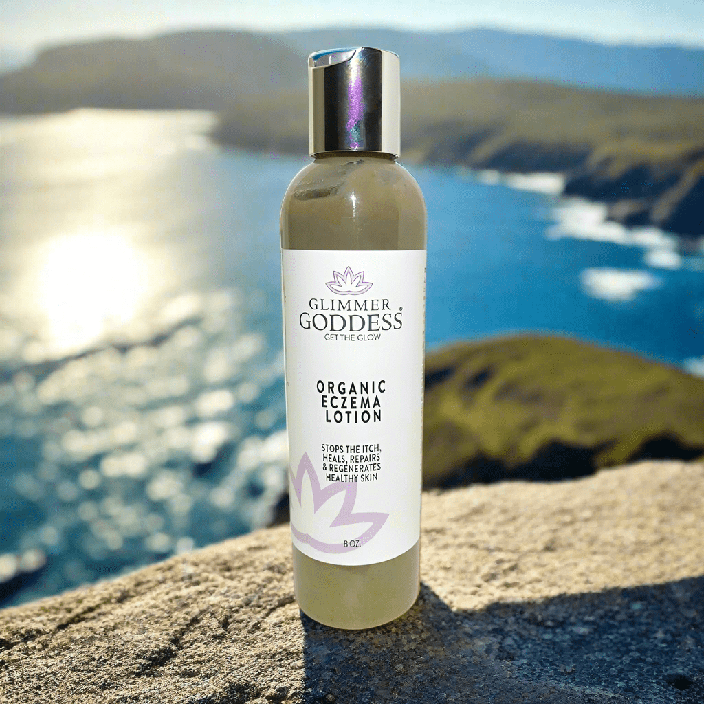 Organic Eczema Lotion - Stop the Itch, Heal The Skin