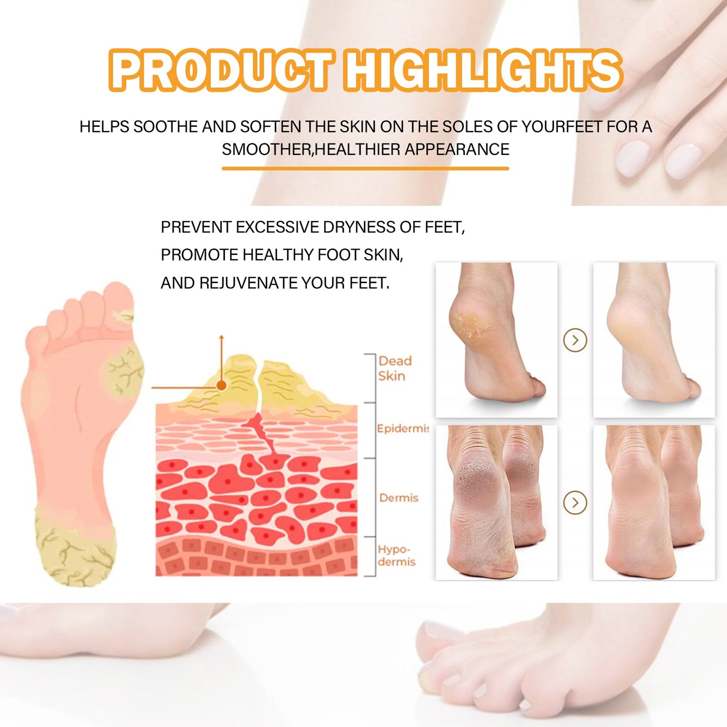 Foot Calluses Moisturizing Spray, Repair Heel Calluses, Remove Dead Skin, Moisturize And Moisturize Foot Care