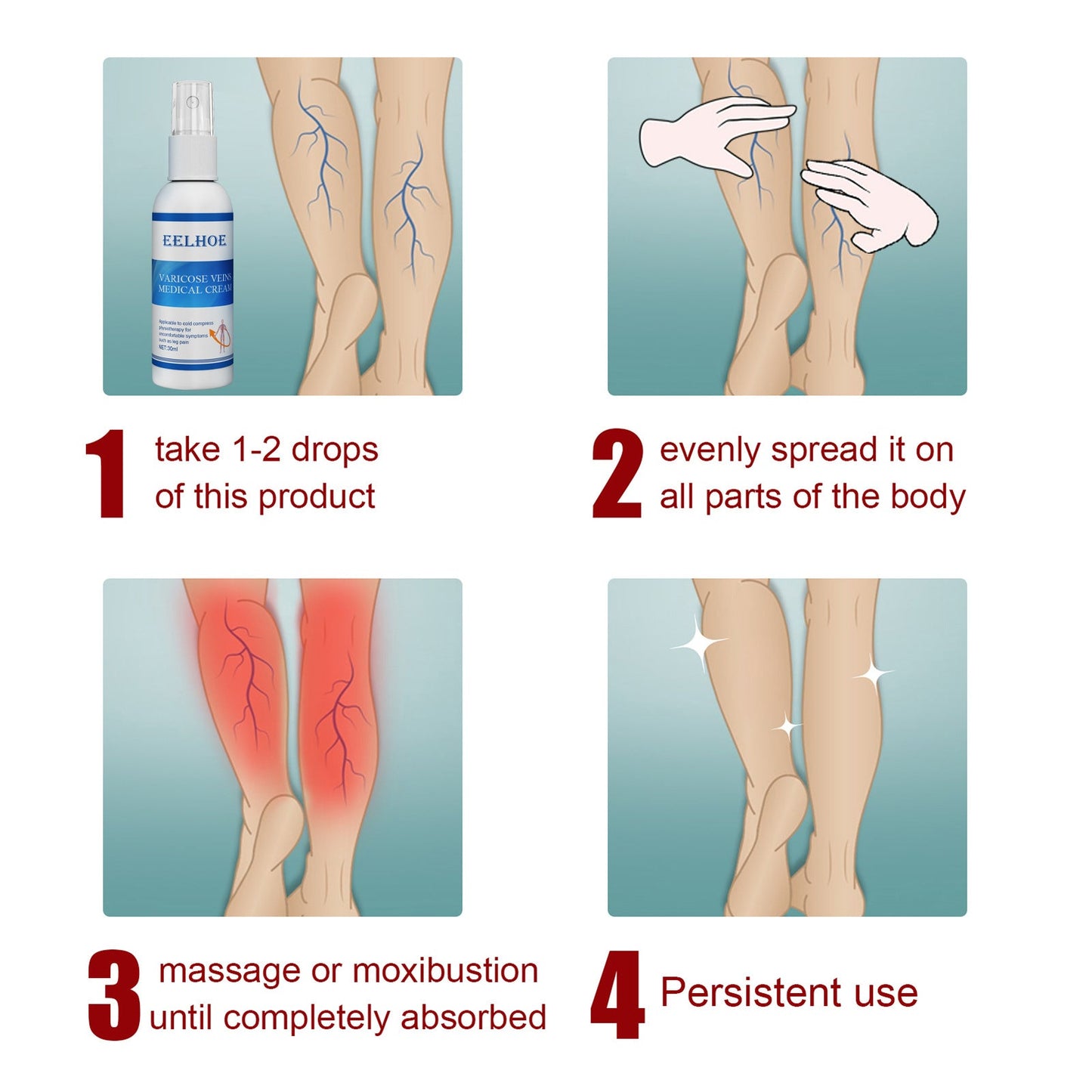 Intravenous Massage Spray For Varicose Veins Relief And Earthworm Leg Blood Vessel Bulge Pain Spray
