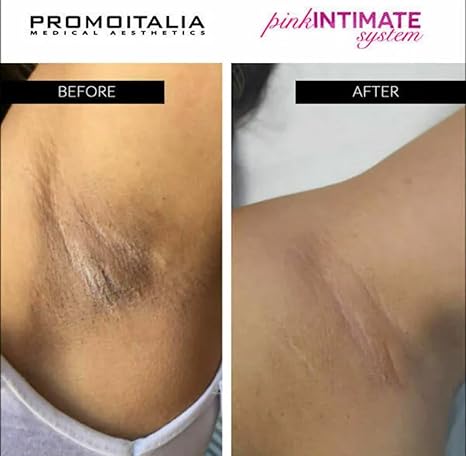 Promoitalia Pink Intimate System Lightening Gel - 1 (One) VIAL x 3 mL Exp. 06/2025