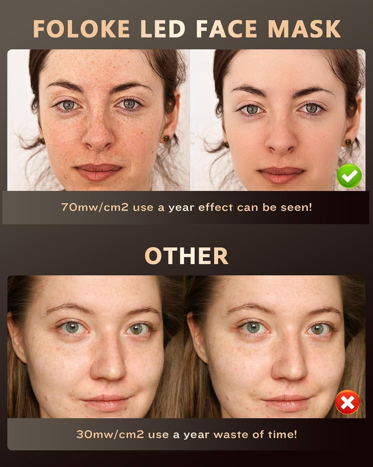 FOLOKE LED Light Therapy Face Mask, Red Light for Skin Rejuvenation, Blue for Relief and Repair, Enhanced Skin Restoration and Double Rejuvenation Effect