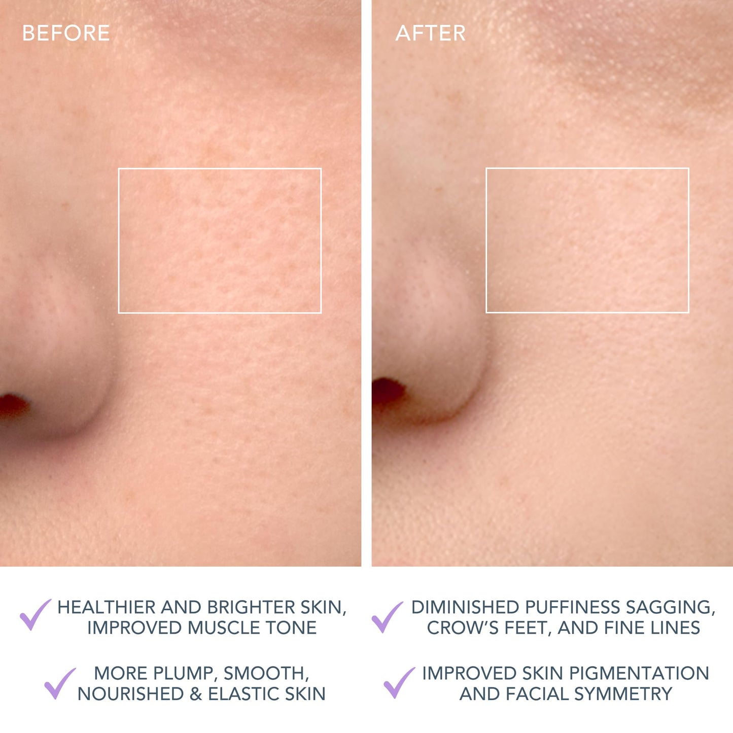 FOREO LUNA 4 Face Cleansing Brush - Firming Face Massager - Anti Aging Care - Enhances Absorption - Simple Skin Care Tools - Sensitive Skin