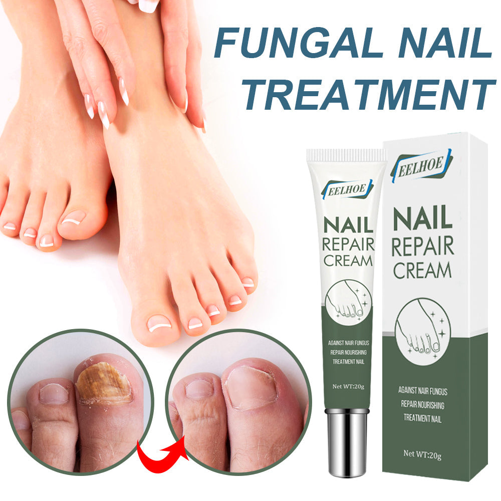Foot Care And Thickening Nail Repair Cream. Nail Repair Cream
