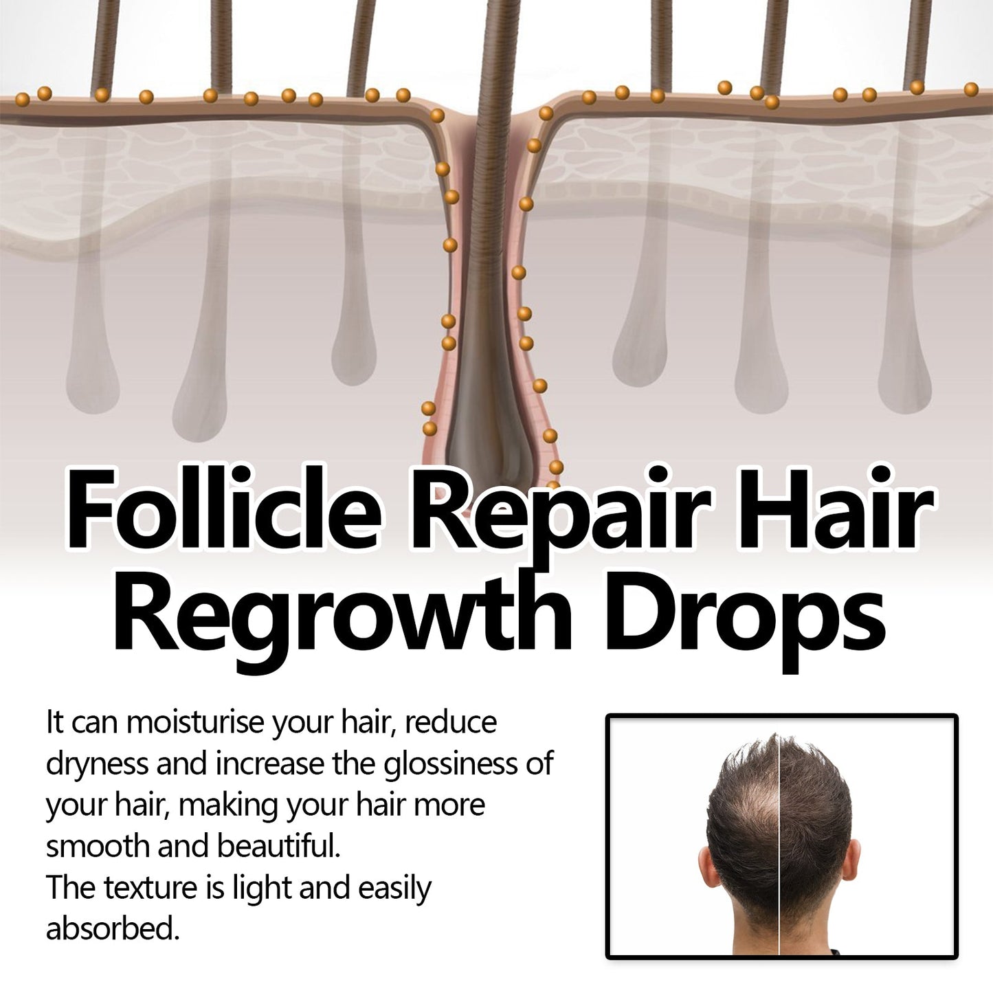 Follicle Repair Hair Regrowth Drops, Hair Protection Strong And Solid Hair Thickening Scalp Nourishing Massage Lotion