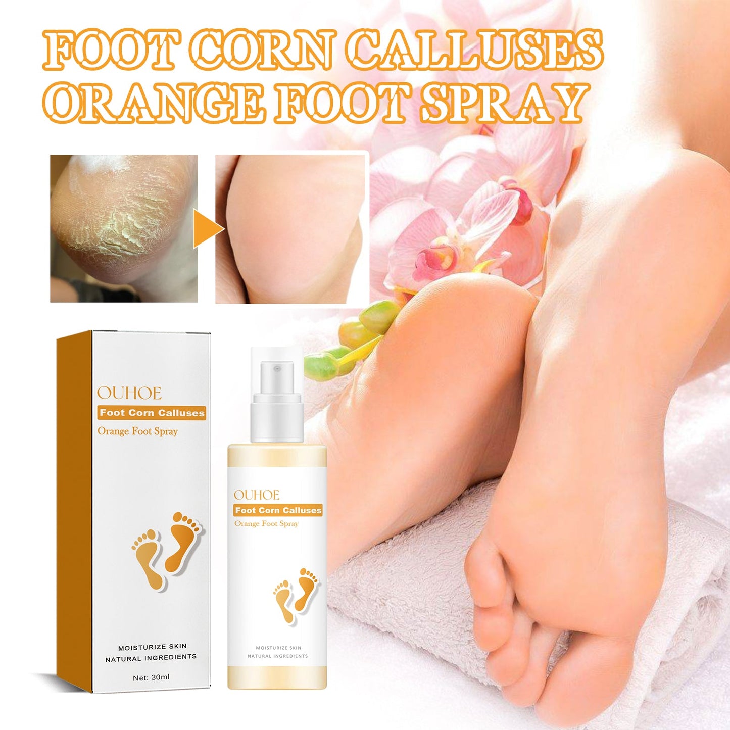 Foot Calluses Moisturizing Spray, Repair Heel Calluses, Remove Dead Skin, Moisturize And Moisturize Foot Care