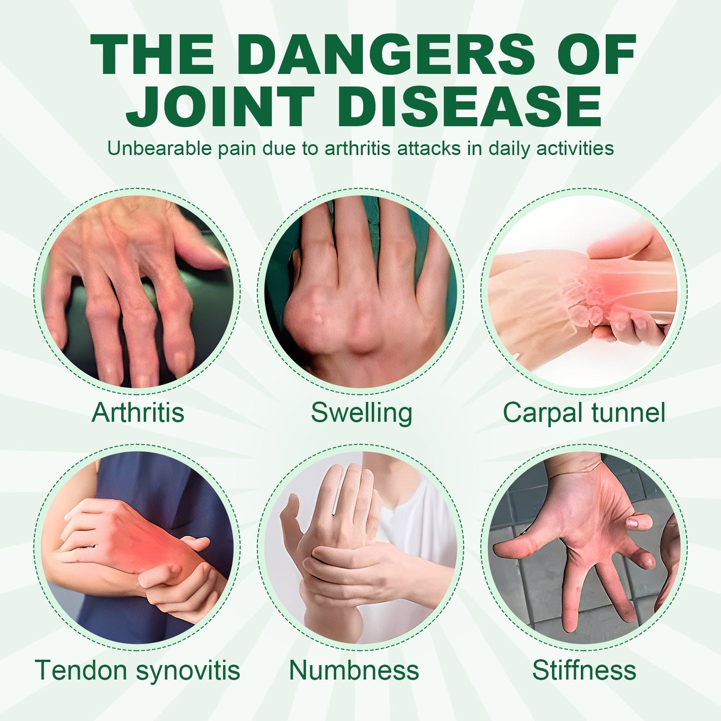 Joint Care Gloves Relieve Thumb Stiffness And Finger Joint Soreness And Swelling Discomfort Care Gloves