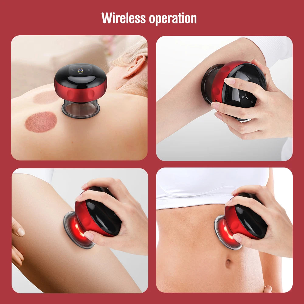 JianYouCare Portable Chinese Electric Vacuum Cupping