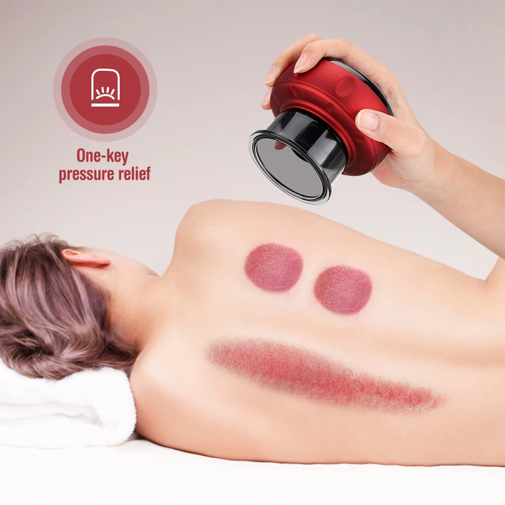 JianYouCare Portable Chinese Electric Vacuum Cupping