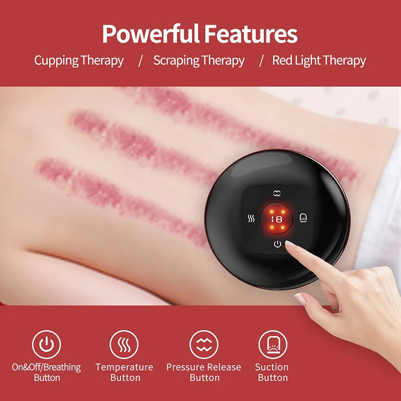 JianYouCare Portable Chinese Electric Vacuum Cupping
