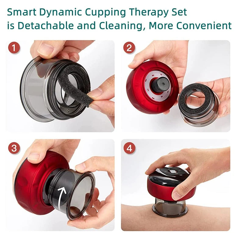JianYouCare Portable Chinese Electric Vacuum Cupping